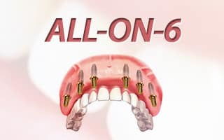gallery 3139